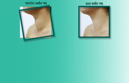 Sóng cao tần