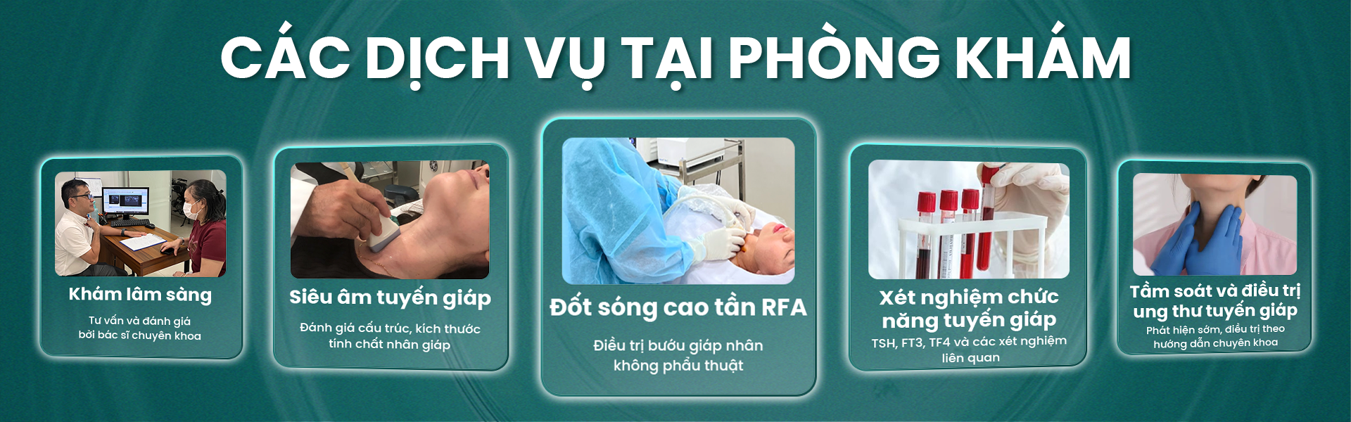 Điều trị bướu giáp nhân bằng sóng cao tần