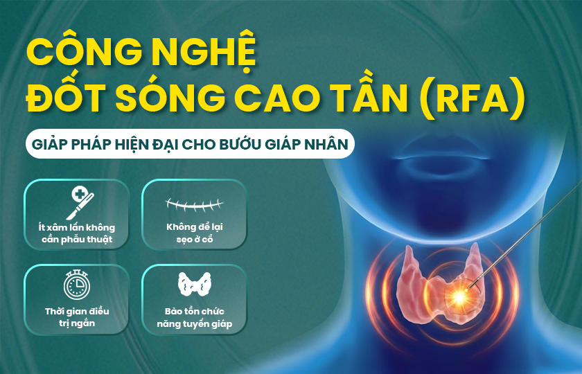 Các phương pháp điều trị bướu giáp nhân