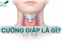 cuong-giap-la-gi-bs-tran-thanh-vy