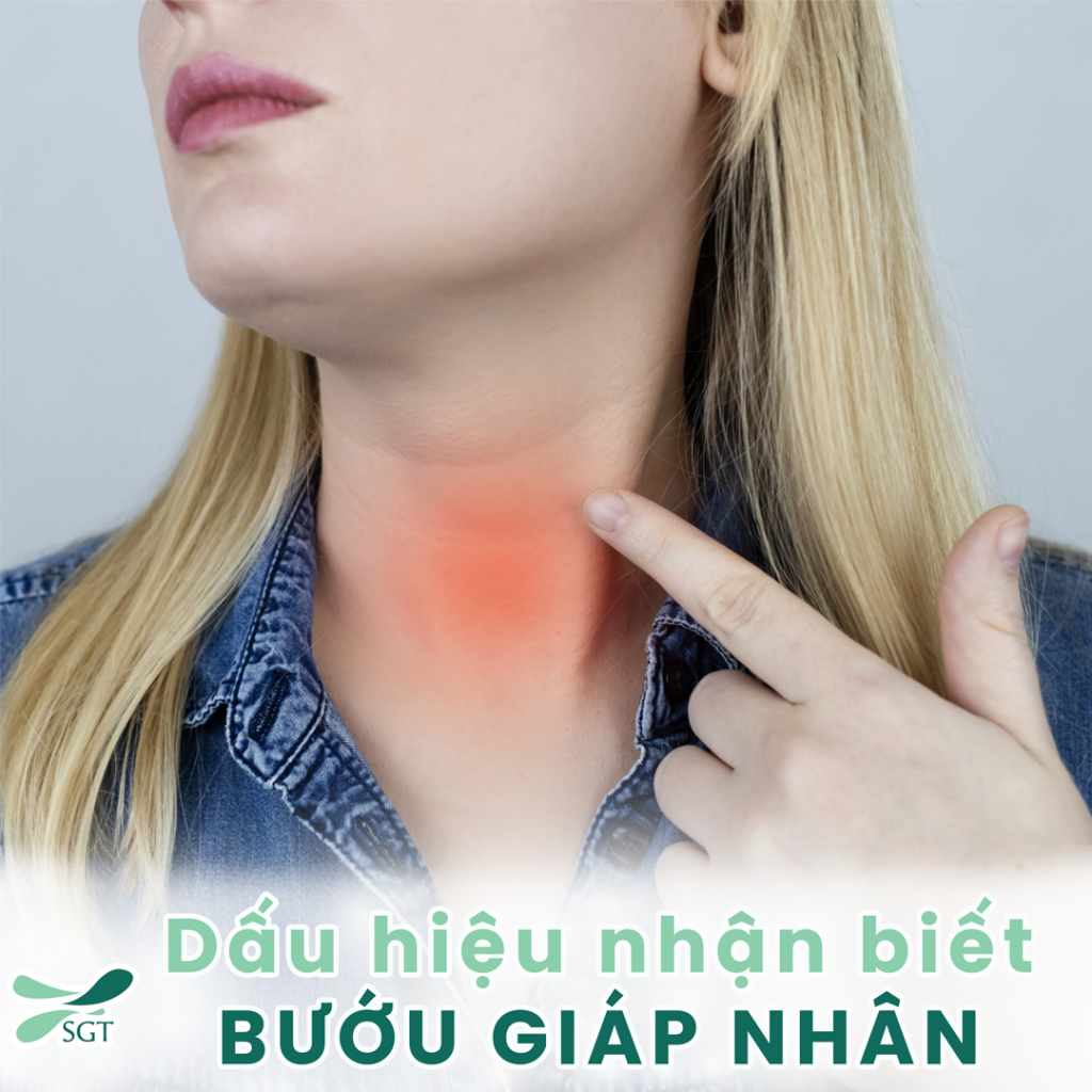 dau-hieu-nhan-biet-buou-giap-nhan