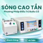 Điều trị bướu cổ bằng sóng cao tần