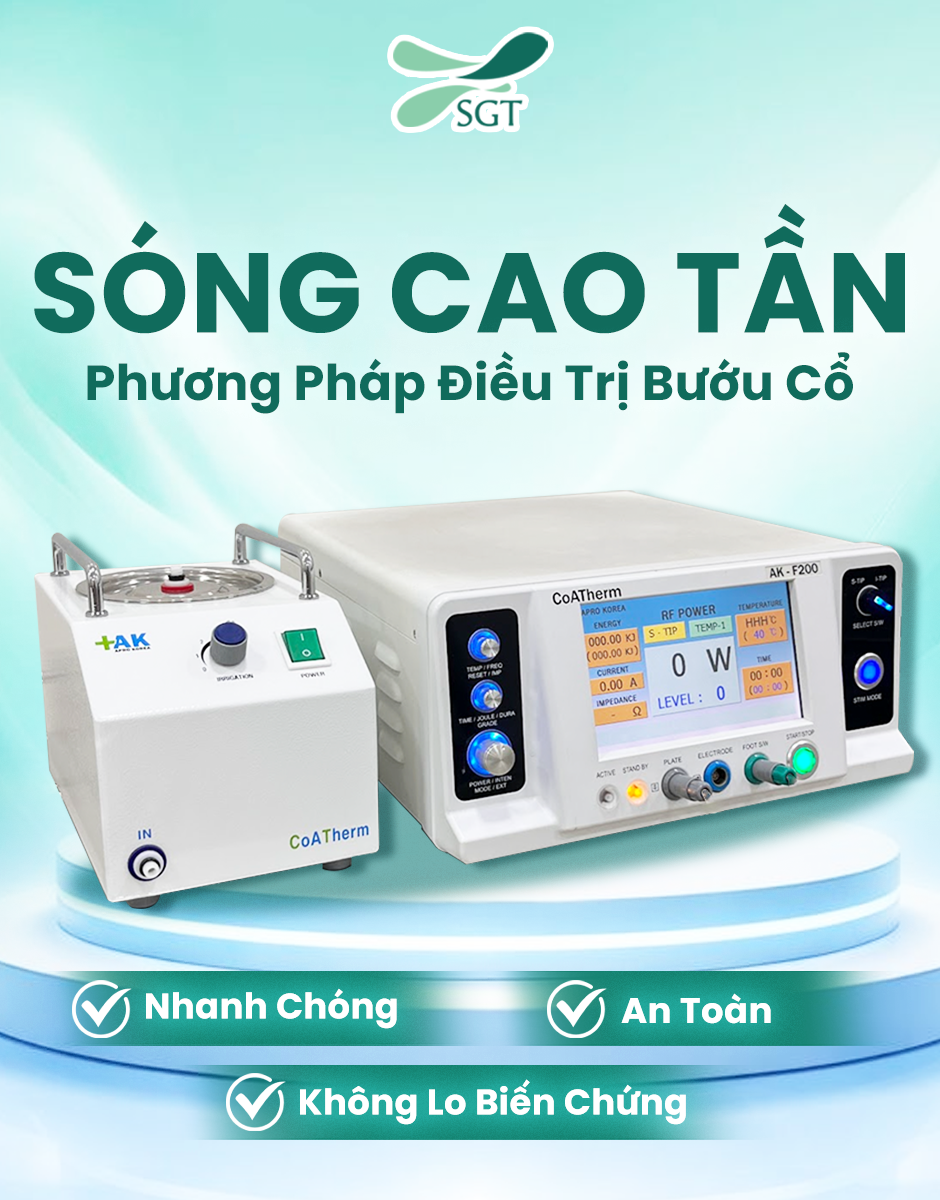 Điều trị bướu cổ bằng sóng cao tần