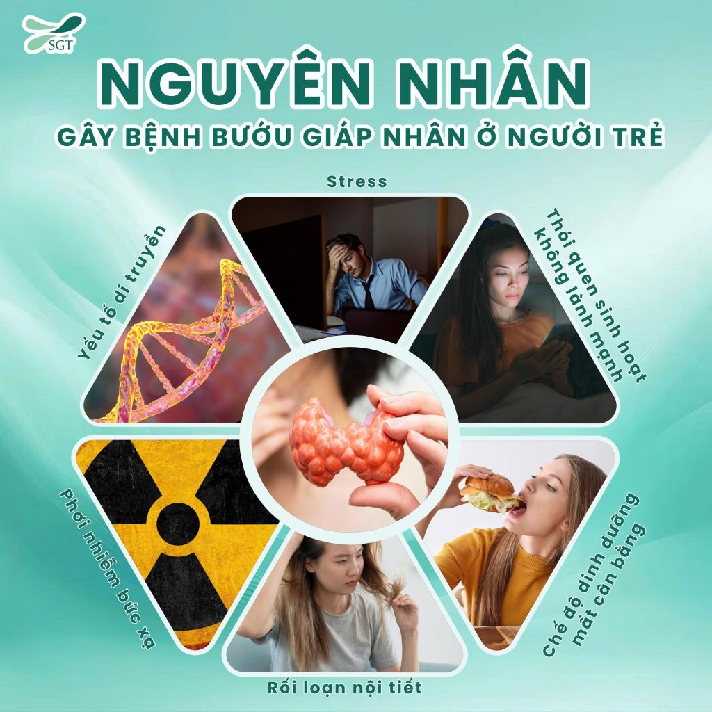 Nguyên nhân gây bệnh bướu giáp nhân ở người trẻ