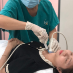 Quy trình sinh thiết bướu giáp bằng kim nhỏ dưới hướng dẫn của siêu âm