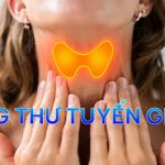 ung-thu-tuyen-giap-dau-hieu-tam-soat