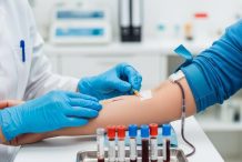 Xét nghiệm chức năng tuyến giáp